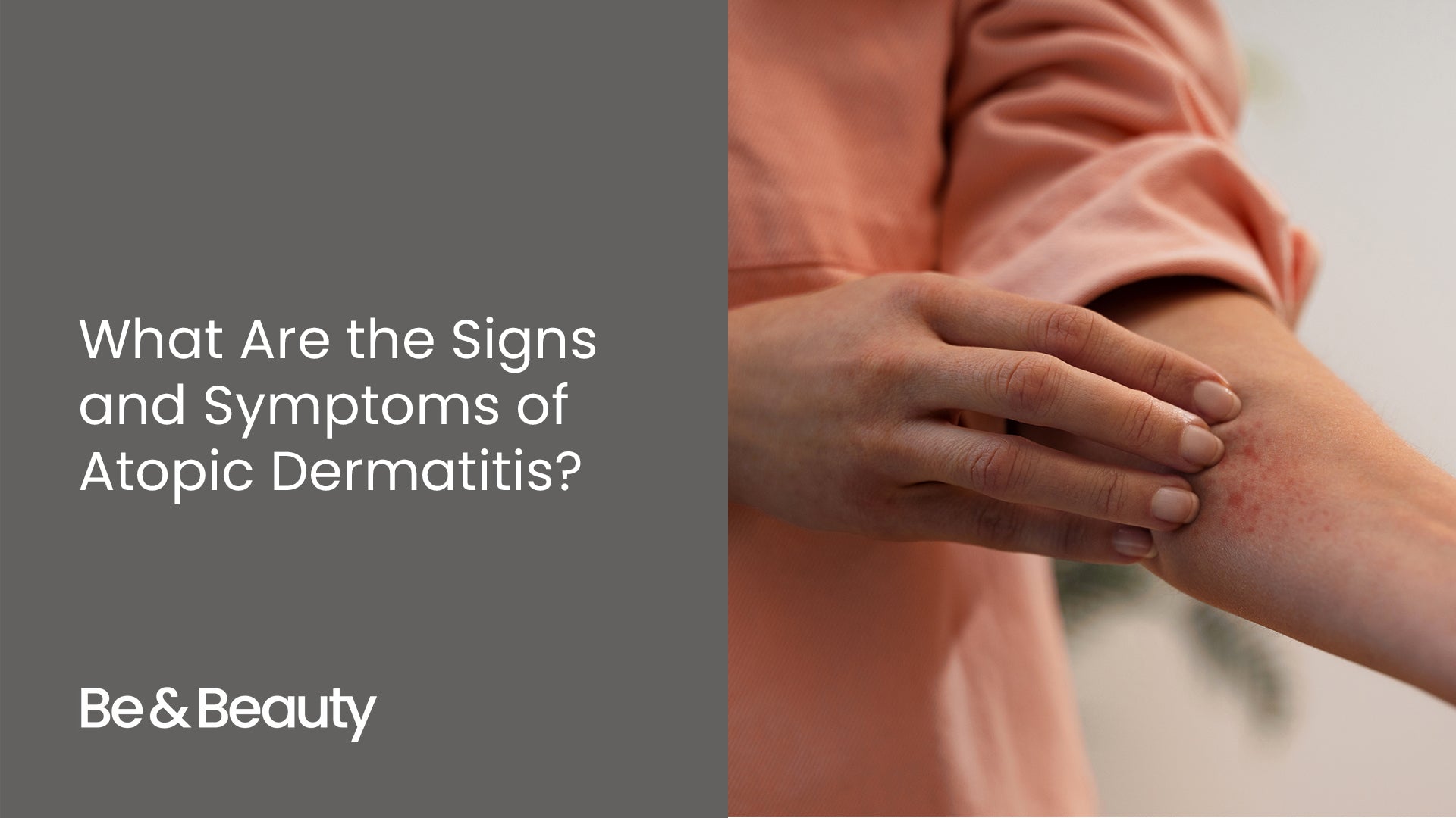 What Are the Signs and Symptoms of Atopic Dermatitis?