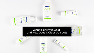 What is Salicylic Acid, and How Does It Clear Up Spots