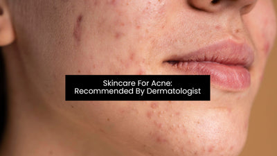 Skincare For Acne: Recommended By Dermatologist