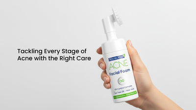 Tackling Every Stage of Acne with the Right Care