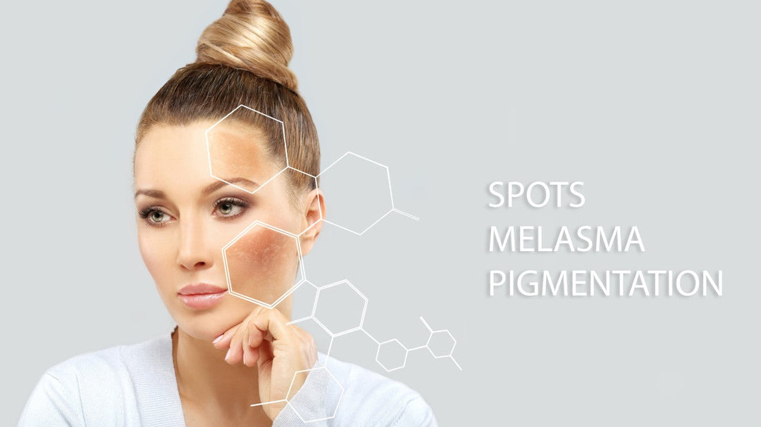 Common Types of Dark Spots: Causes, Prevention, and How to Maintain an Even Skin Tone
