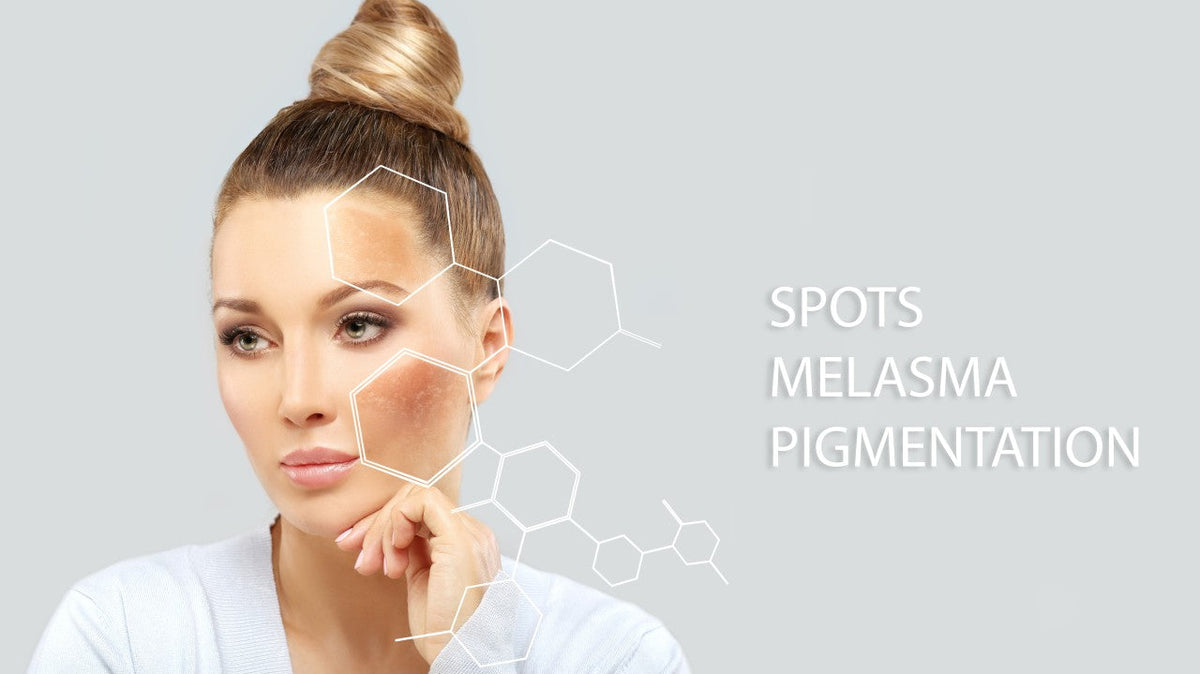 Common Types of Dark Spots: Causes, Prevention, and How to Maintain an Even Skin Tone