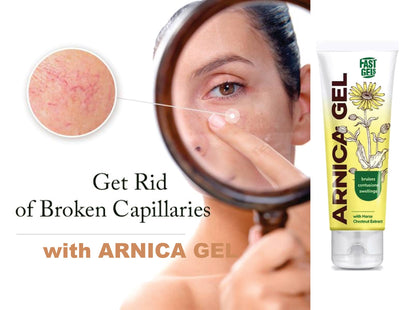 Arnica & Chestnut gel – 50 g