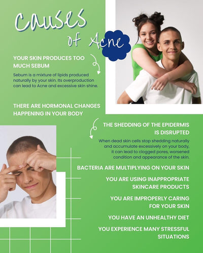 Novaclear Acne Pores-Off Serum – Treatment for Acne Pores On Face with Niacinamide, Salicylic Acid and Azelaic Acid – Targets Blackheads, Whiteheads and Post-acne scars - 30 ML