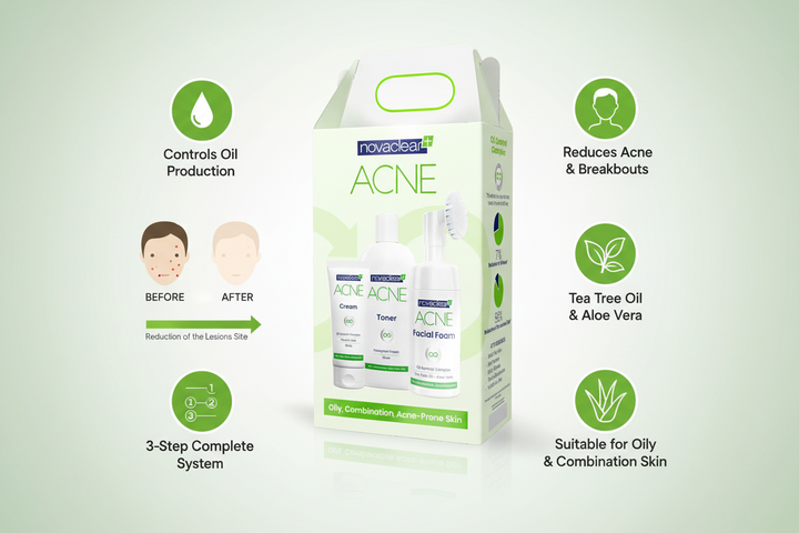 Acne treatment product packaging with branding and features on a light green background