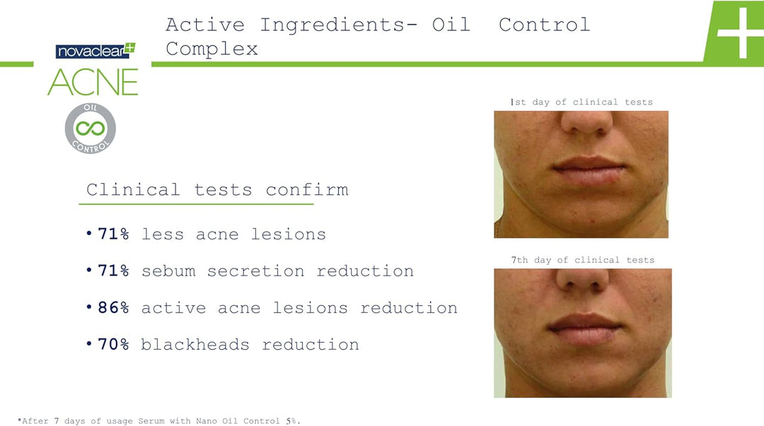 Advertisement for a acne treatment product with clinical test results on a white background