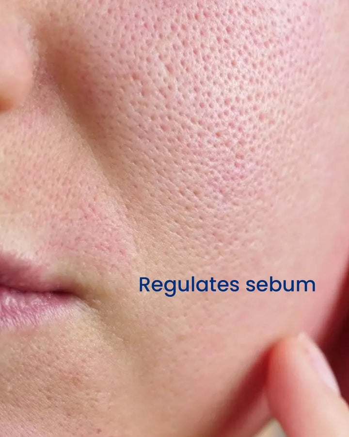 Close-up of skin texture with text &