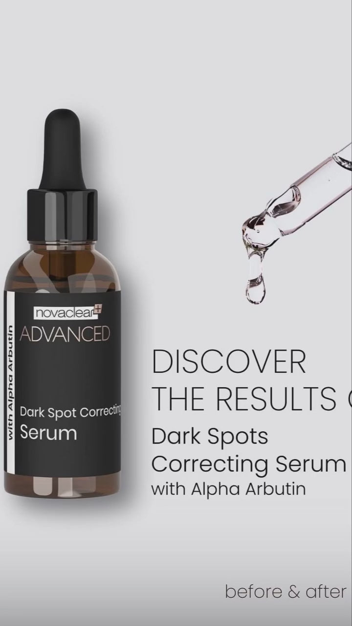 Novaclear Advanced Dark Spot Correcting Serum with 2% Alpha Arbutin, Melavoid &amp; Azeloglycine – Skin Discoloration Lightening Serum – Brightening &amp; Hyperpigmentation Treatment – 30 ML