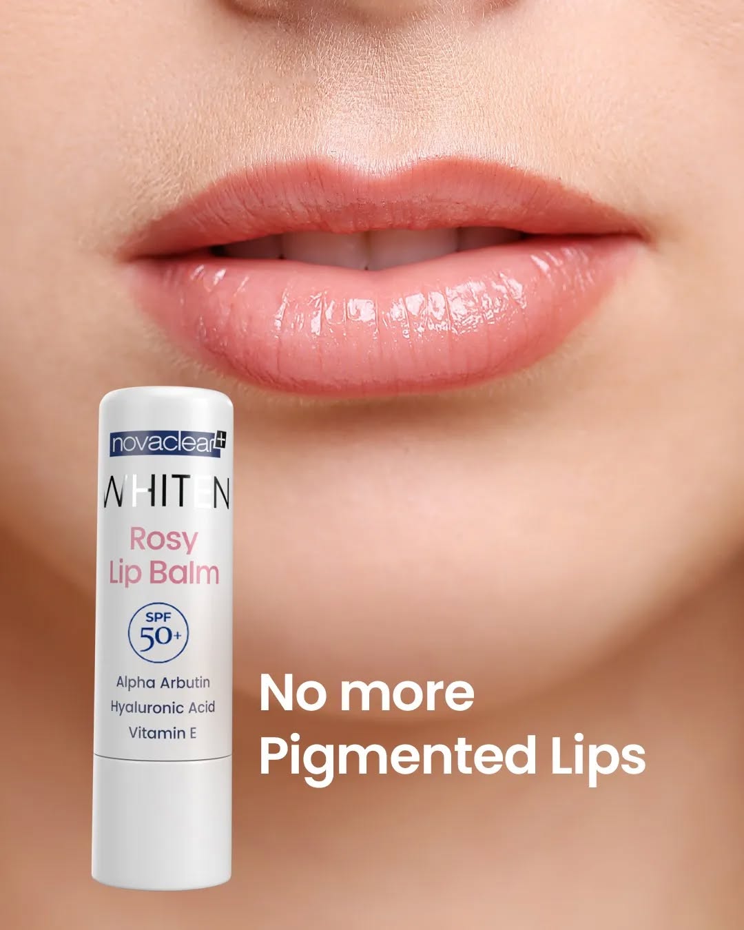 Novaclear Rosy Lip Balm - 4.9g SPF50 Sun Protection, Moisturizing, Dark Prevention for Pigmented &amp; Dark Lips | For Women &amp; Men